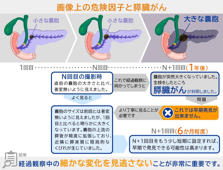 膵臓がんを早期発見する当院の取組みについて Aic画像検査センター